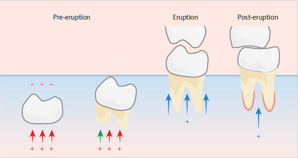 MTA vs. Biodentine for the Management of Open Apex in Immature Teeth